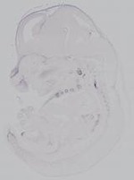 EMAGE:14968