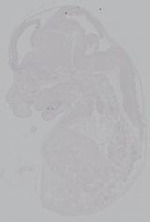 EMAGE:14970