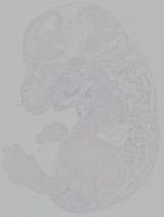 EMAGE:14970
