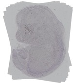 EMAGE:14970