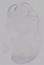 EMAGE:14975