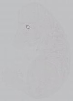 EMAGE:14976