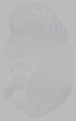 EMAGE:14978