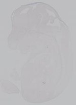 EMAGE:14987
