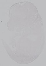 EMAGE:14987