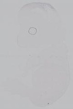 EMAGE:14987