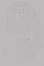 EMAGE:14990