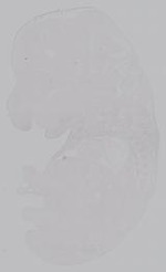 EMAGE:14992