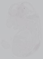 EMAGE:14996