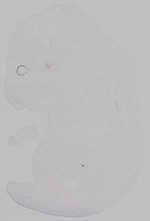 EMAGE:14999
