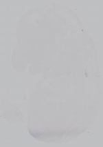EMAGE:14999