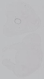 EMAGE:14999