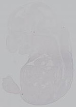 EMAGE:15001