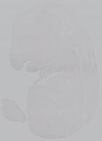 EMAGE:15001