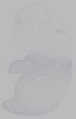 EMAGE:15011
