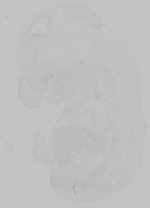 EMAGE:15017