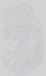 EMAGE:15041