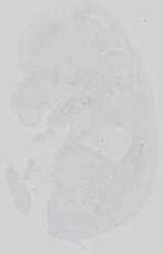 EMAGE:15041