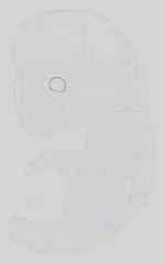 EMAGE:15046