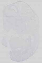 EMAGE:15049