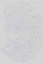 EMAGE:15049