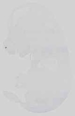 EMAGE:15054