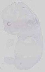 EMAGE:15057