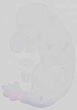 EMAGE:15057