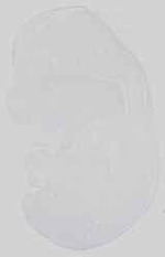 EMAGE:15058