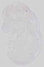 EMAGE:15059