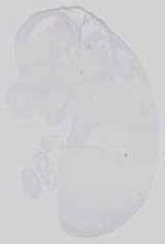 EMAGE:15059