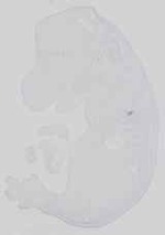 EMAGE:15059