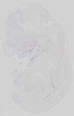 EMAGE:15060