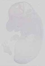 EMAGE:15063