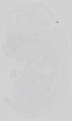 EMAGE:15069