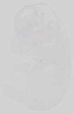 EMAGE:15073