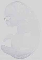 EMAGE:15077