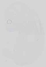 EMAGE:15077