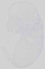 EMAGE:15091