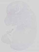 EMAGE:15115