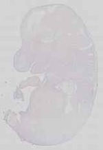 EMAGE:15116