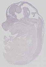 EMAGE:15119