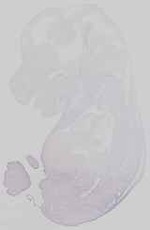 EMAGE:15133