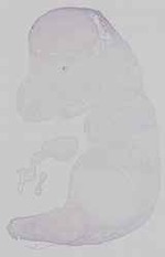 EMAGE:15142