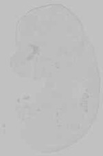 EMAGE:15143