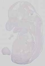 EMAGE:15146