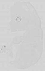EMAGE:15146