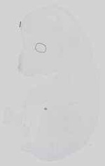 EMAGE:15150