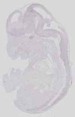 EMAGE:15161