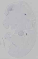 EMAGE:15164